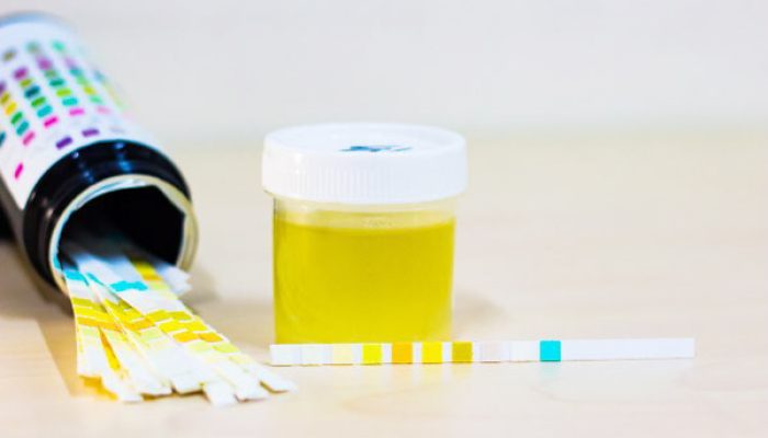 Nah Loh! Jelang Lebaran Sopir-sopi di Banten Jalani Dites Urine